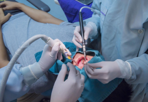 Read more about the article Kirurgjia Dentale: Nje Hulumtim i thelluar në Trajtimin Kirurgjik të Problemeve Dentare